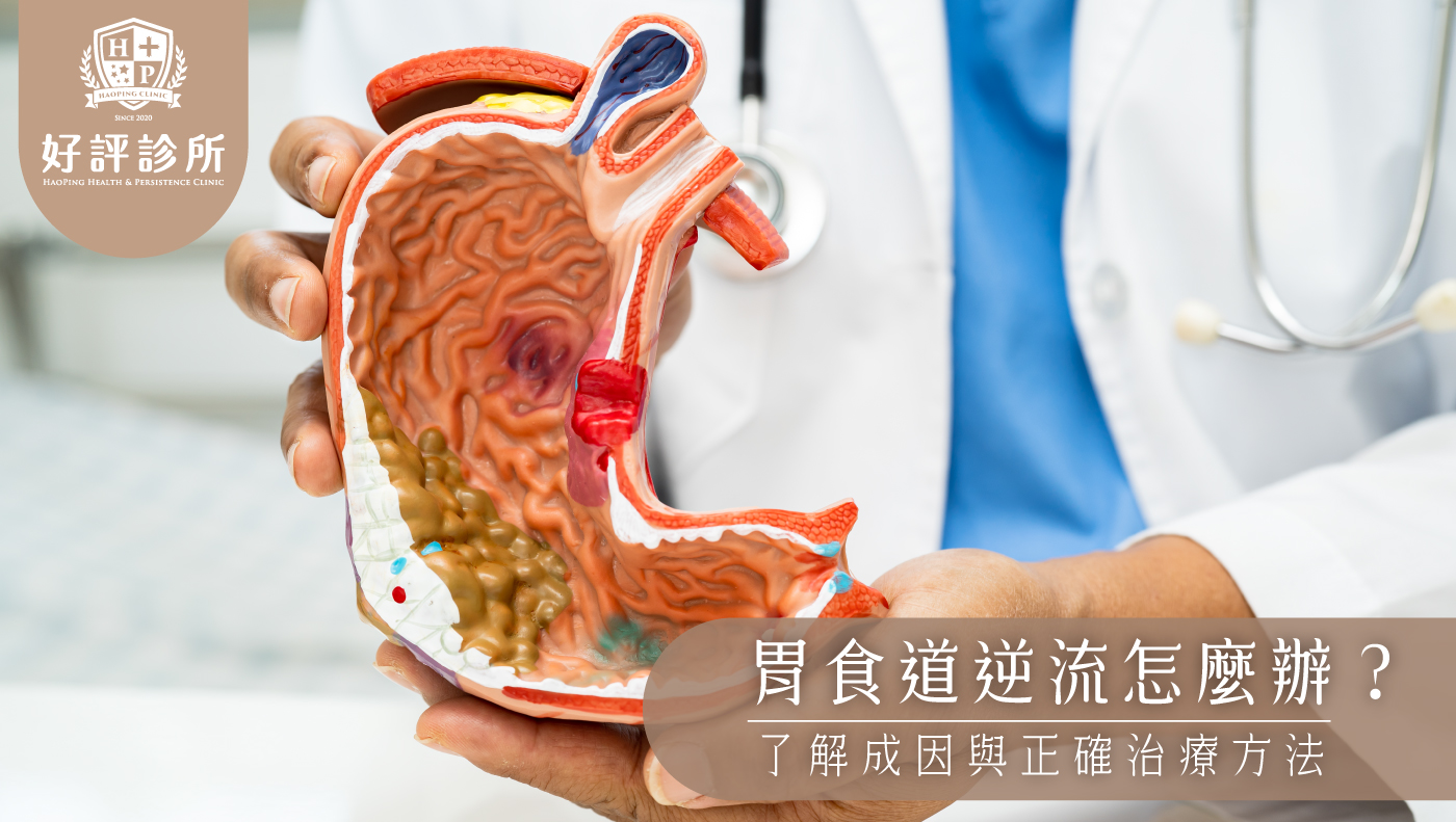 胃食道逆流