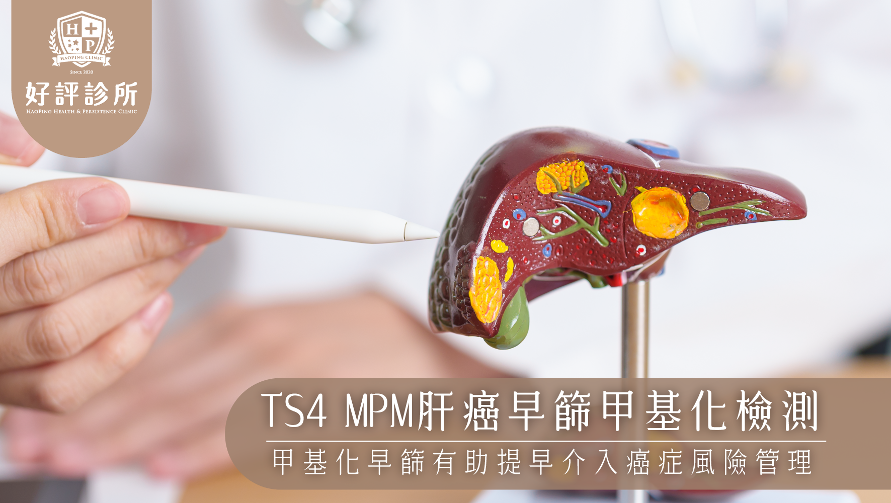 TS4 MPM肝癌早篩甲基化檢測